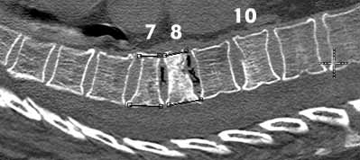 Traumatologie F r Den Handheld Palm IPhone Trauma Radiologie 